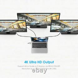 Lention Usb C Docking Station Hub Hdmi Ethernet Jack Adaptateur Av Pour Macbook Pro
